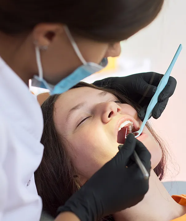 Caring for Your Dental Crowns