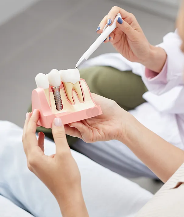 How to Care for Your Dental Implants
